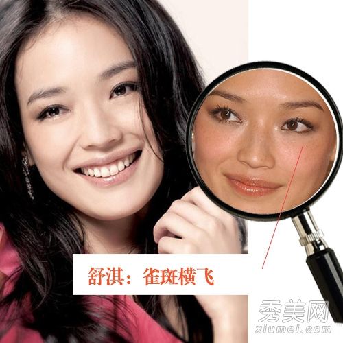 赵薇，舒淇，浓妆下的真脸皮肤缺损