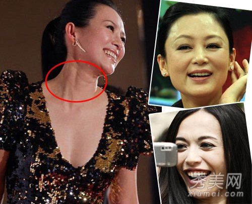 杨陈皱纹秀25岁以上老年女性注意皱纹