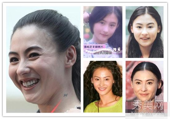 改变脸型，消除皱纹