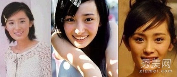 整形手术前后,整形外科医生大军袭击了李玟和容祖儿。太不像话了。