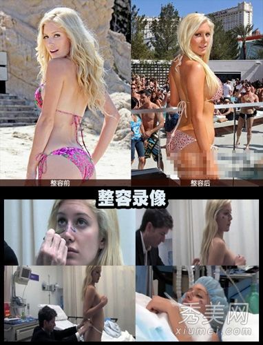 美国女演员开启30个整形手术