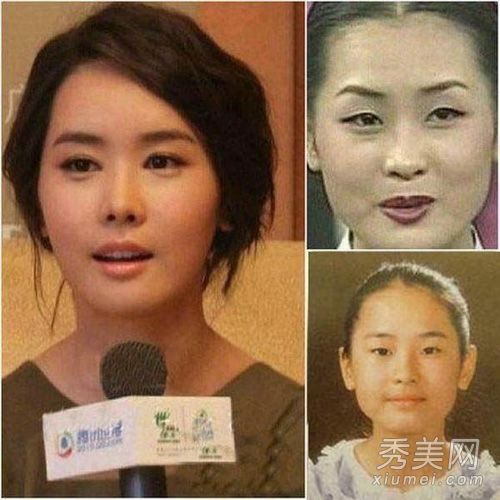李多海领衔16名韩国和中国女演员在整容手术前后的PK