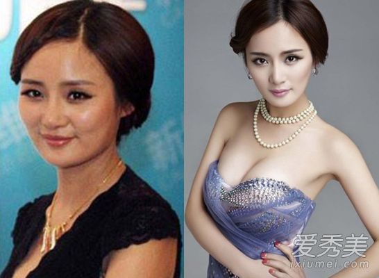 十位公开承认整形手术+隆胸的女明星(对比)