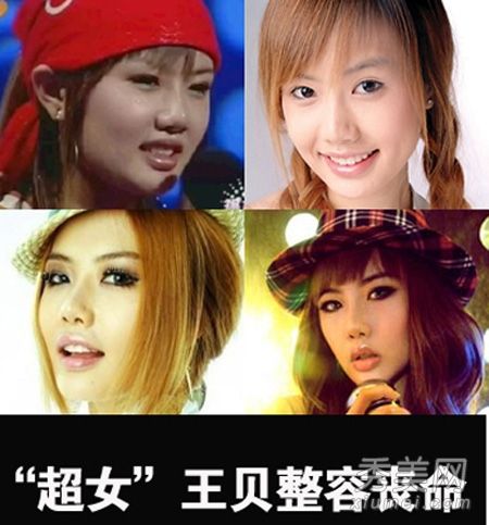 整形手术失败后,娱乐圈十大女演员成为“女鬼”