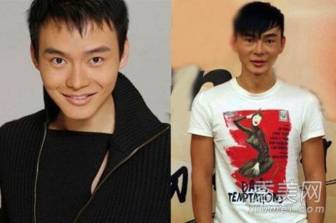 明星美容减肥上瘾美容失败自杀风险