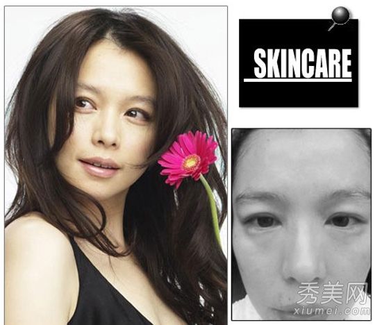 碧台雪兰冬季急诊过敏皮肤的护理