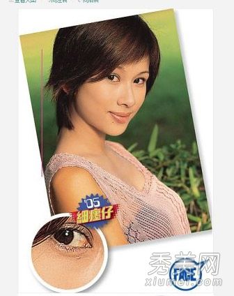 赵雅芝大明星肖强接受了整形手术,已经变得面目全非。