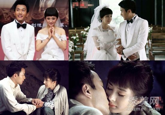 深陷整形手术谣言的“整形手术爱好者”正在将过去与现在进行比较。