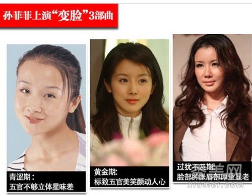 专业人士透露一线女演员的整容手术