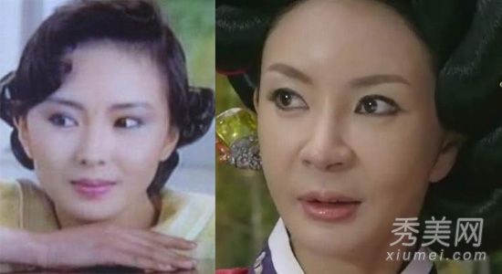 蒋透明质酸化妆品失败揭示女演员变脸真相