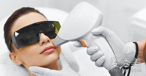 激光点痣能恢复多久？激光点痣多久能恢复正常肤色？