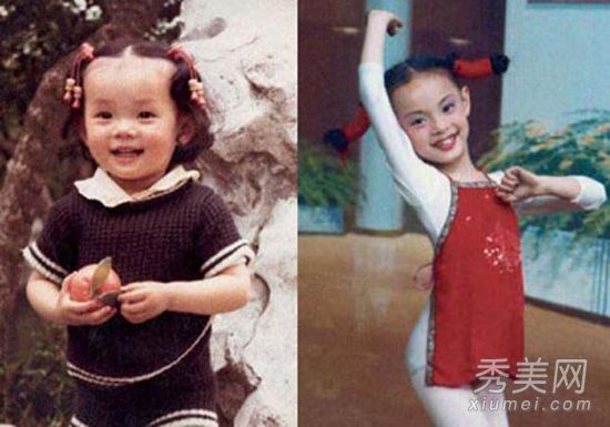 孙力为隆鼻术发明了自己的夹子，这可信吗？