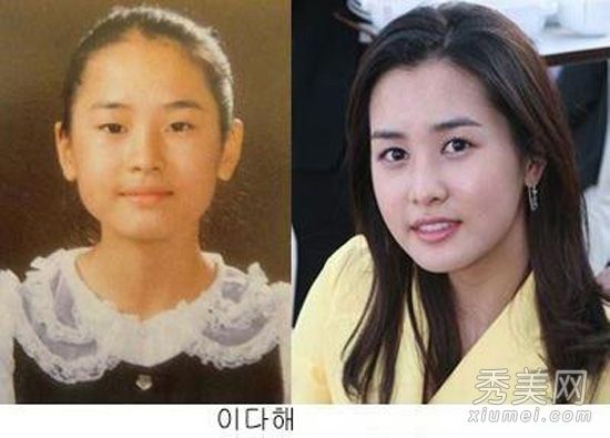 他们没有做过整形手术吗?图揭示13位女演员变脸的真相