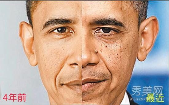 奥巴马的老龄化计划帮助你延缓衰老