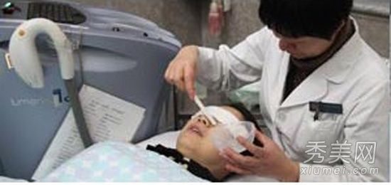 体验医学美容:揭示激光去除痤疮和黑斑的过程