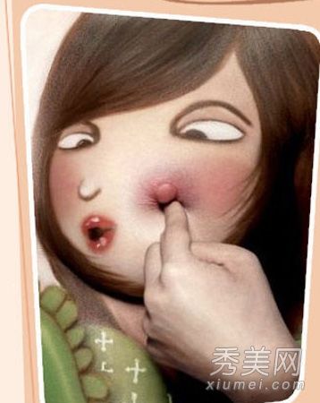 额头上的粉刺怎么办?五步强力祛痘法