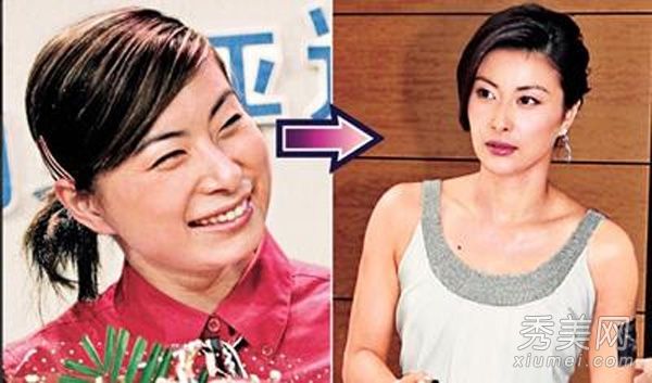 网络名人整容和隆鼻很流行