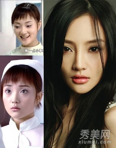 有照片证明娱乐圈的11个美女都做过整容手术或化妆。