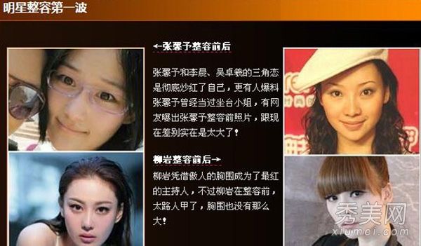 照片显示整形手术前后十大娱乐明星的证据