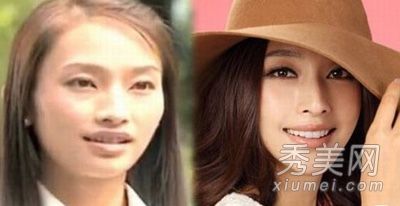 通过整容手术,女演员成为张莉最受欢迎的演员