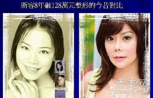 所有女演员都患有面部整形手术后遗症、鼻子变形、神经坏死。