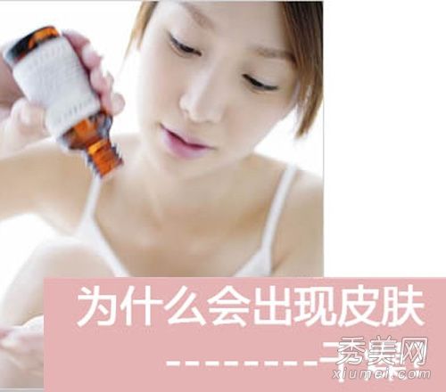 如何护理毛孔粗大、长痘痘的六大问题