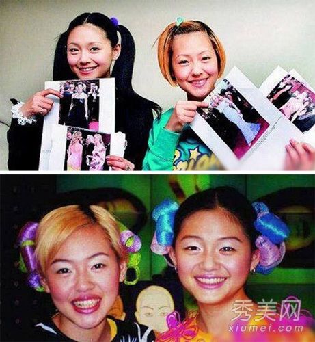 女明星与整形外科。减肥会在脸上留下“缺陷”。