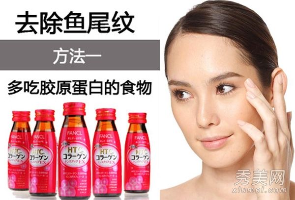 眼睛细纹是最明显的。MM4移动移除鱼尾纹