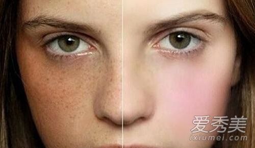 妊娠纹的原因是什么？如何去除妊娠纹？如何预防它们