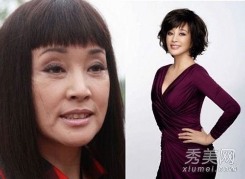 明星最爱的小塑料瞬间嫩肤女孩