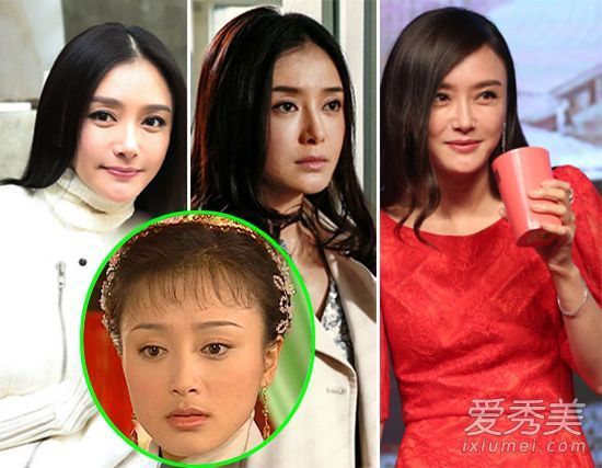 整容手术后，这位女演员的脸变得僵硬而美丽。她不太贪婪。