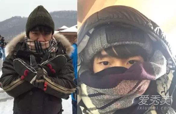 严重的面部失明!这些星星击中了婴儿的脸,把他吓死了!