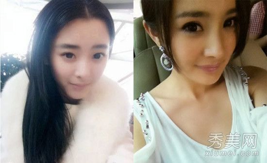 艺术考生与明星面对面展示5大微型整形手术