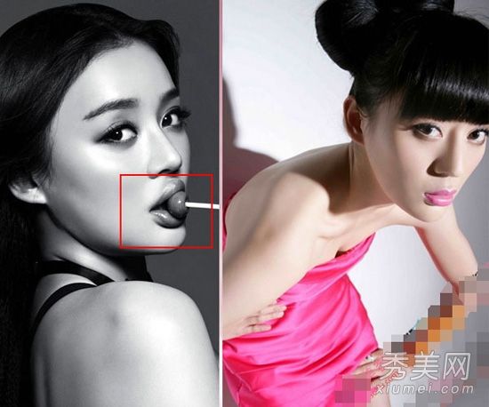 袁珊珊怀疑过度整容暴露了腊肠口僵硬的面孔