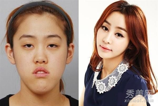 胖屋“易容”美容明星整容失败案例曝光