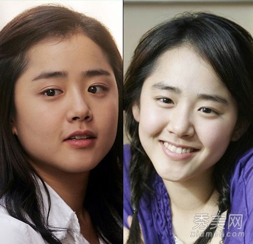 女演员的大大小小的脸会立刻改变，教你快速消肿，变成瓜子脸