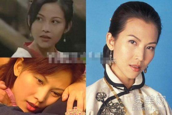 12名女演员怀疑整容失败杨萧艺强“被毁”