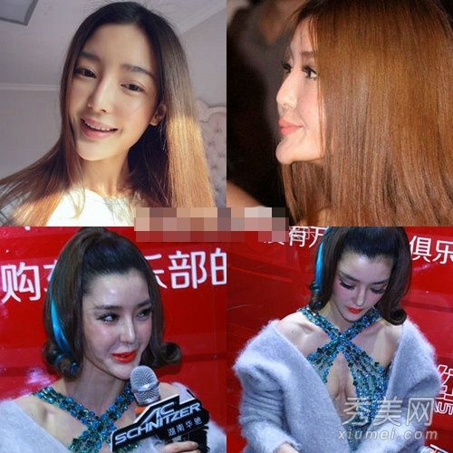 27“整容”女演员闫星整容失败后变成面瘫(1)