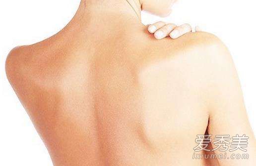 背部的粉刺可以刮掉吗？背部痤疮会传染吗？