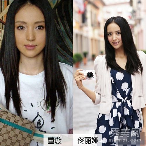 女演员整容组遭遇大S暗示张雨绮整容