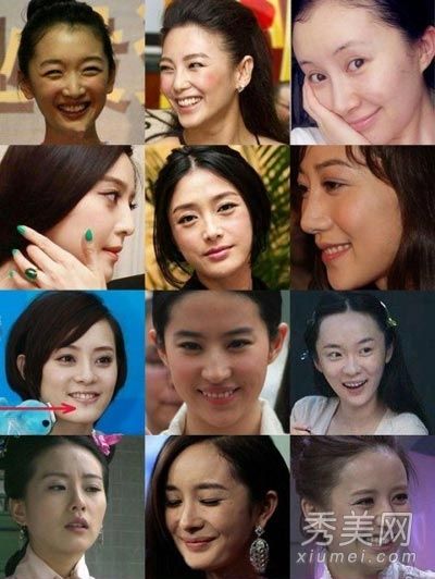 杨满脸皱纹痘痘石狮的皮肤已经严重暴露而且难看