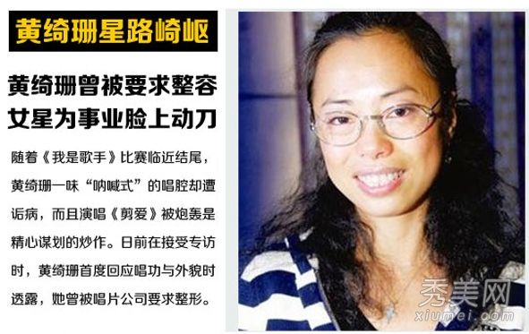 黄岐山被批评为“太丑”，并被要求接受整形手术