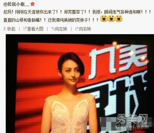 郑爽整形手术后的照片,暴露了鼻子增大,嘴唇形状变化和面部变化