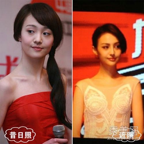 郑爽和周东宇90后女演员整容后不再纯洁