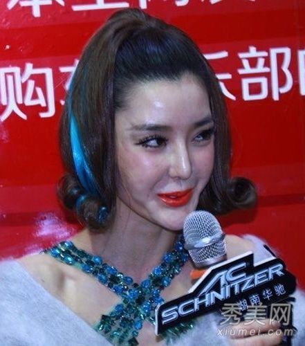照片显示14名女演员在整容失败后面部毁容