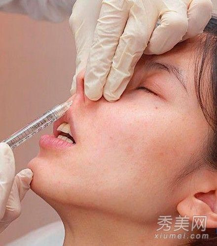 31岁的香港艺术家陈思琪展示整容照片