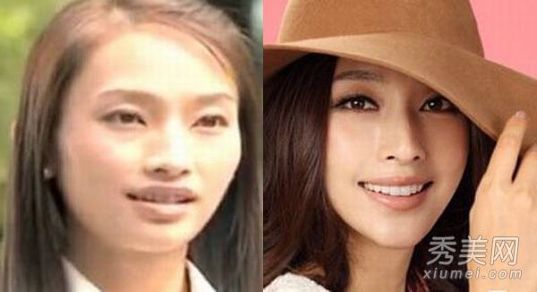 来自依奥拉、戚薇和邓佳佳的二线女演员通过整形手术获得晋升。