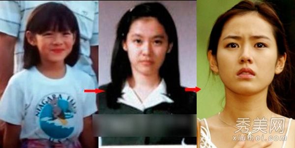 蔡妍尹恩惠15名韩国女演员的老照片展示整形手术过程