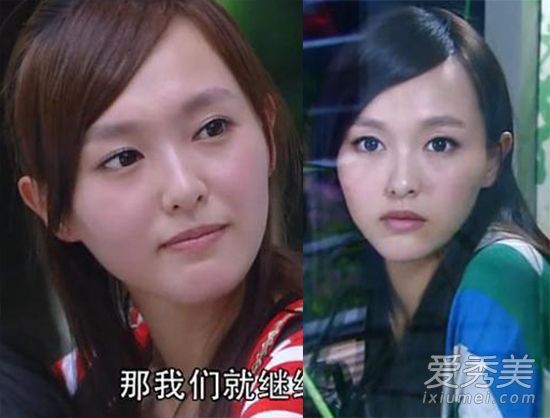 图为唐嫣的“重伤员”龅牙+倒唇+大脑门