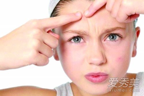 痤疮持续吗？避免这些地雷食物！